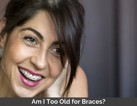 Woman with braces smiling with the words, Am I too old for braces?